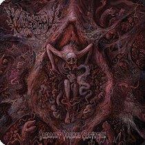16.3.2025News Vulvectomy