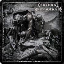 20.12.2024News Cerebral Hemorrhage